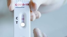 Test covid coronavirus sassari