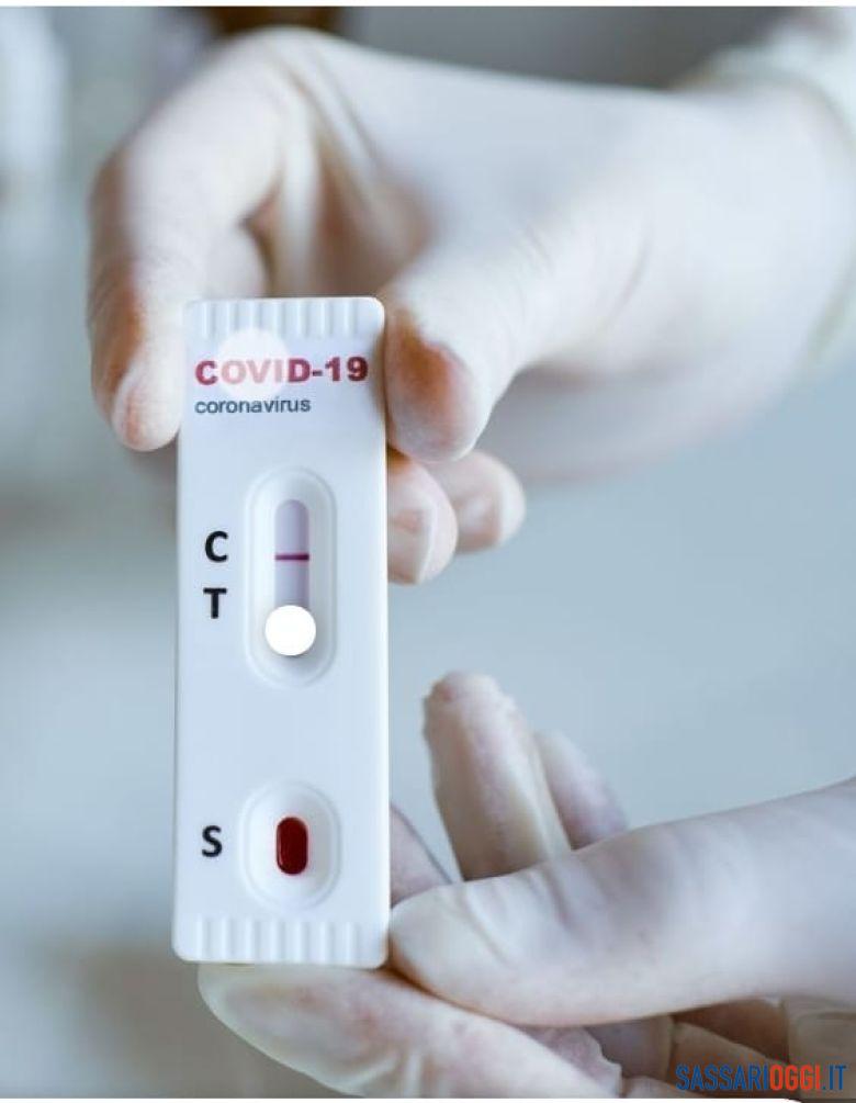 Test covid coronavirus sassari